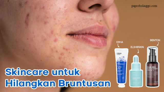 Rekomendasi Produk Skincare