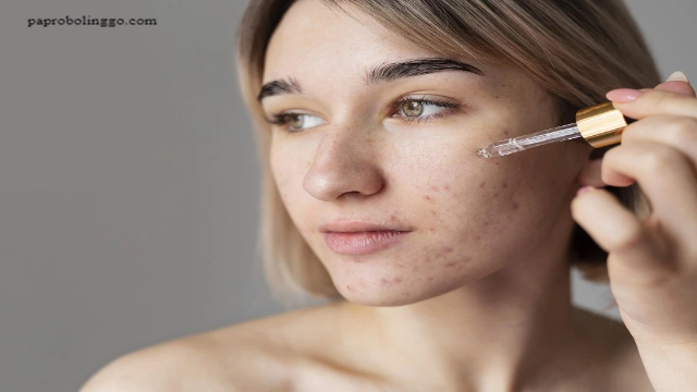Produk Skincare untuk Menghilangkan Flek Hitam